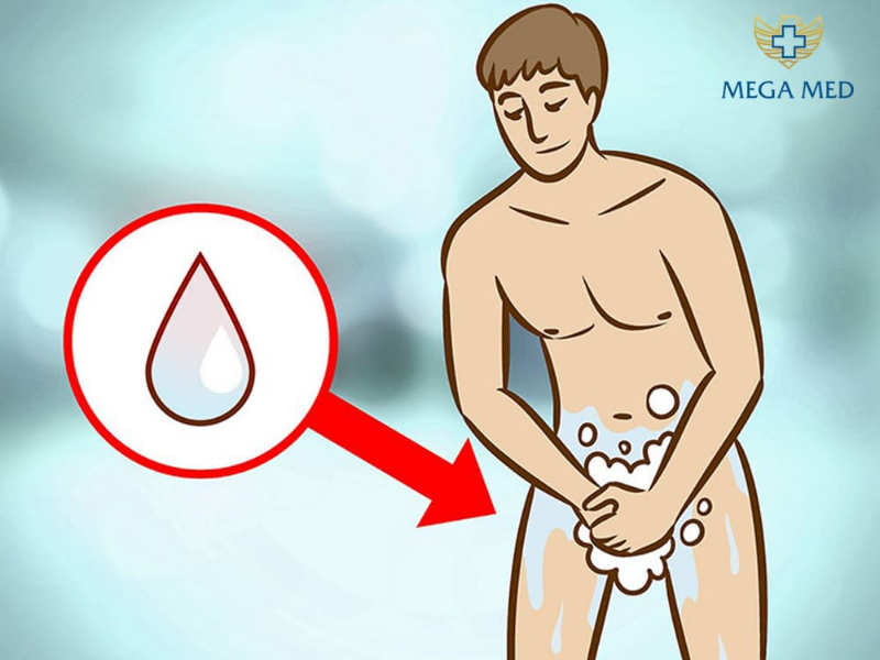 Vệ sinh sau khi cắt bao quy đầu 